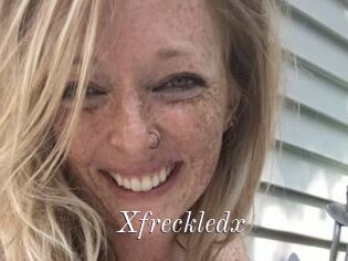 Xfreckledx